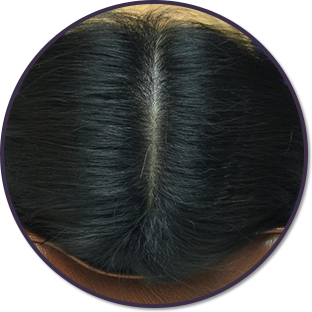 육모단계 머리사진