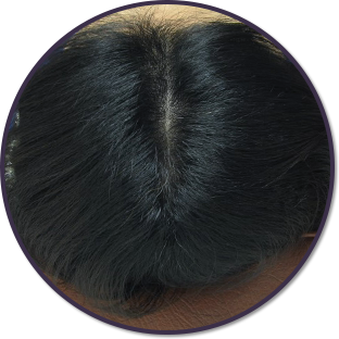 양모단계 머리사진