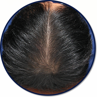 육모단계 머리사진